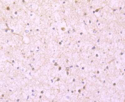 Immunohistochemistry-Paraffin: Ferritin Light Chain Antibody (JM10-37) [NBP2-66836]