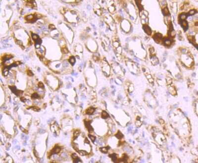 Immunohistochemistry-Paraffin: Ferritin Light Chain Antibody (JM10-37) [NBP2-66836]