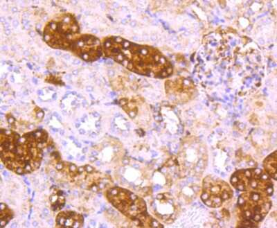 Immunohistochemistry-Paraffin: Ferritin Light Chain Antibody (JM10-37) [NBP2-66836]