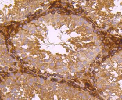 Immunohistochemistry-Paraffin: Ferritin Light Chain Antibody (JM10-37) [NBP2-66836]