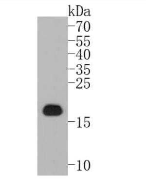 Western Blot: Ferritin Light Chain Antibody (JM10-37) [NBP2-66836]