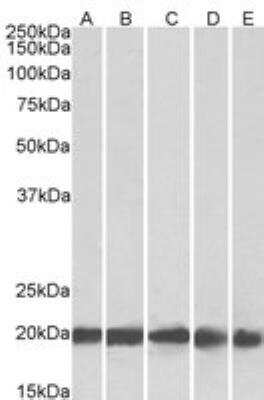 Western Blot: Ferritin Light Chain Antibody [NBP1-06986]