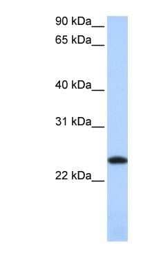 Western Blot: Ferritin Light Chain Antibody [NBP1-54948]
