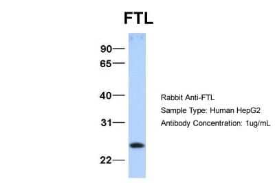 Western Blot: Ferritin Light Chain Antibody [NBP1-54948]