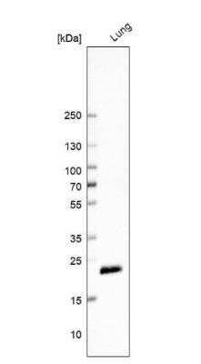 Western Blot: Ferritin Light Chain Antibody [NBP2-34072]