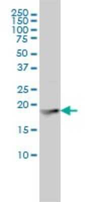 Western Blot: Ferritin Light Chain Antibody (X1) [H00002512-M16]