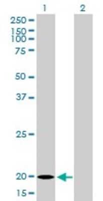 Western Blot: Ferritin Light Chain Antibody (X1) [H00002512-M16]