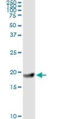 Western Blot: Ferritin Light Chain Antibody (X1) [H00002512-M16]