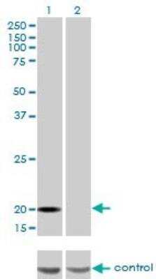 Western Blot: Ferritin Light Chain Antibody (X1) [H00002512-M16]