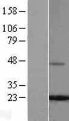 Western Blot: Ferritin Light Chain Overexpression Lysate [NBL1-10851]