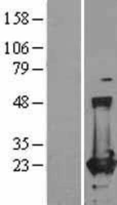 Western Blot: Ferritin Heavy Chain Overexpression Lysate [NBL1-10850]