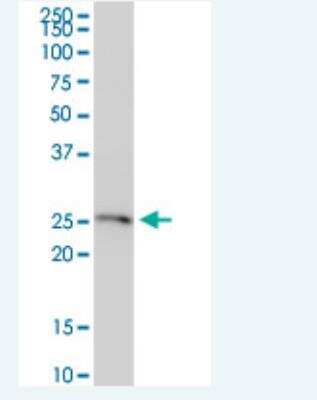 Western Blot: Ferritin mitochondrial Antibody (6G3) [H00094033-M05-100ug]