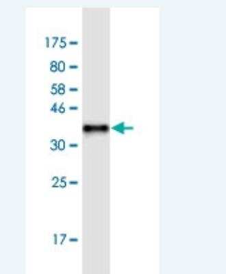 Western Blot: Ferritin mitochondrial Antibody (6G3) [H00094033-M05-100ug]