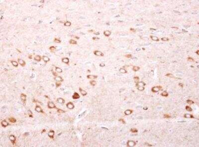 Immunohistochemistry-Paraffin: Ferritin mitochondrial Antibody [NBP2-14961]
