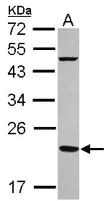 Western Blot: Ferritin mitochondrial Antibody [NBP2-14961]