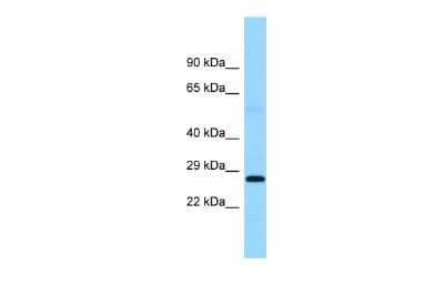 Western Blot: Ferritin mitochondrial Antibody [NBP2-86630]