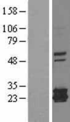 Western Blot: Ferritin mitochondrial Overexpression Lysate [NBL1-10852]