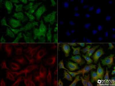 Immunocytochemistry/Immunofluorescence Analysis of Ferroportin/SLC40A1 in HepG2 Cells