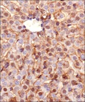 Immunohistochemical Detection of Ferroportin/SLC40A1 in Murine Liver