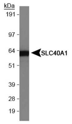 Western Blot Detection of Ferroportin/SLC40A1 in Human Intestine Lysate