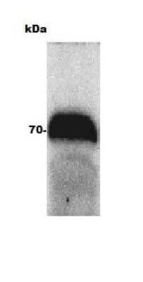 Western Blot Detection of Ferroportin/SLC40A1 in Bovine Adult Eye