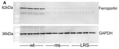 Western Blot Staining of Microsomal Ferroportin/SLC40A1 in Mouse Livers