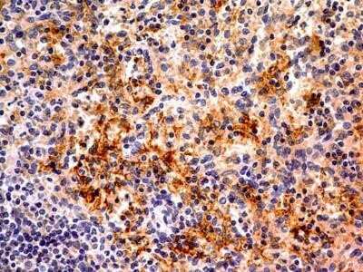 Immunohistochemistry: Ferroportin/SLC40A1 Antibody (8G10NB) - Azide and BSA Free [NBP2-45357]