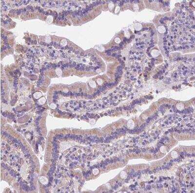 Immunohistochemistry-Paraffin: Ferroportin/SLC40A1 Antibody [NBP2-49454]