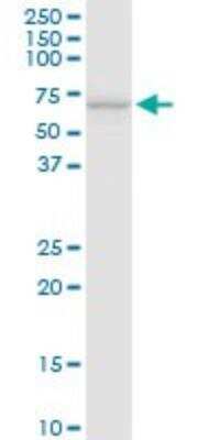 Western Blot: Ferroportin/SLC40A1 Antibody [H00030061-D01P]