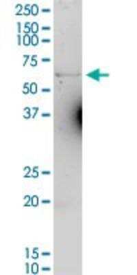 Western Blot: Ferroportin/SLC40A1 Antibody [H00030061-D01P]
