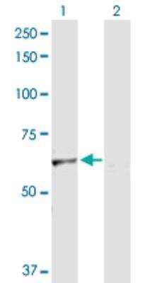 Western Blot: Ferroportin/SLC40A1 Antibody [H00030061-D01P]