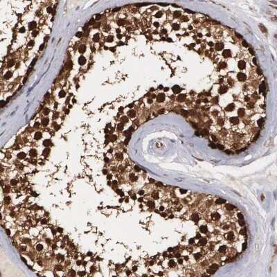 Immunohistochemistry-Paraffin: Fes Antibody [NBP1-83429]