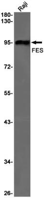 Western Blot: Fes Antibody (S02-2F6) [NBP3-19633]