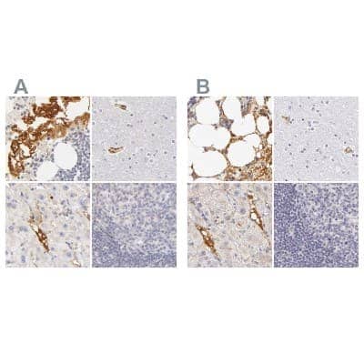 Immunohistochemistry-Paraffin: Fetuin A/AHSG Antibody [NBP1-90302]