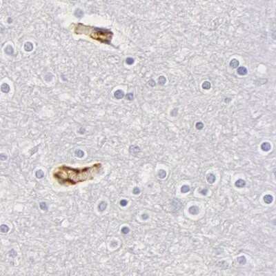 Immunohistochemistry-Paraffin: Fetuin A/AHSG Antibody [NBP1-90302]