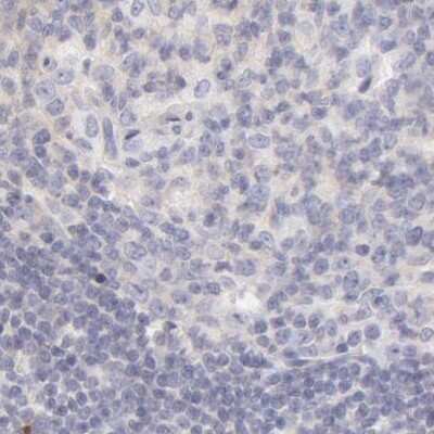 Immunohistochemistry-Paraffin: Fetuin A/AHSG Antibody [NBP1-90302]