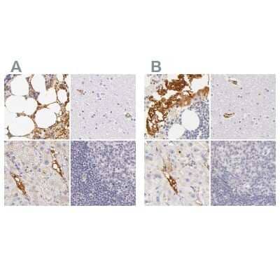 Immunohistochemistry-Paraffin: Fetuin A/AHSG Antibody [NBP1-90303]