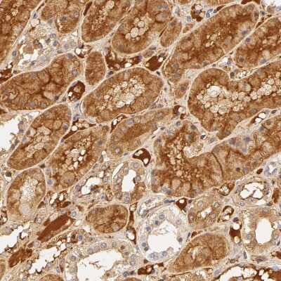 Immunohistochemistry-Paraffin: Fetuin A/AHSG Antibody [NBP1-90303]