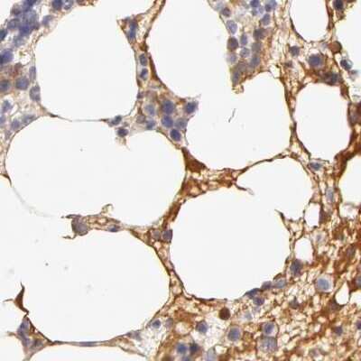 Immunohistochemistry-Paraffin: Fetuin A/AHSG Antibody [NBP1-90303]