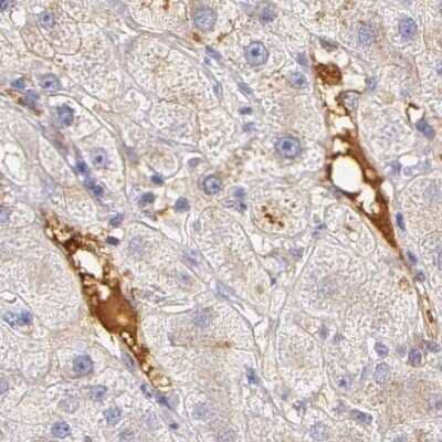 Immunohistochemistry-Paraffin: Fetuin A/AHSG Antibody [NBP1-90303]