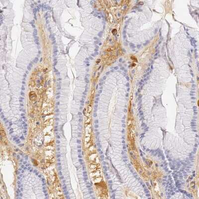 Immunohistochemistry-Paraffin: Fetuin A/AHSG Antibody [NBP1-90303]