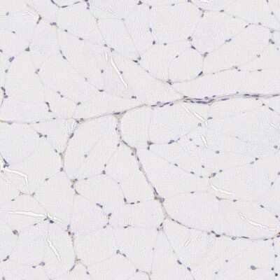 Immunohistochemistry-Paraffin: Fetuin A/AHSG Antibody [NBP1-90303]