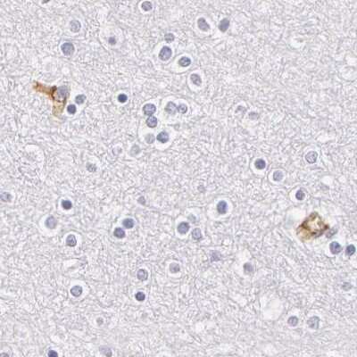 Immunohistochemistry-Paraffin: Fetuin A/AHSG Antibody [NBP1-90303]