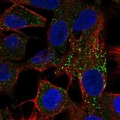 Immunocytochemistry/ Immunofluorescence: Fetuin Antibody [NBP3-17712]