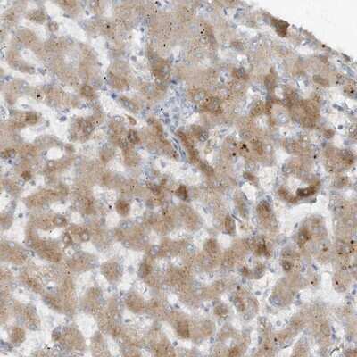 Immunohistochemistry-Paraffin: Fetuin Antibody [NBP1-91192]