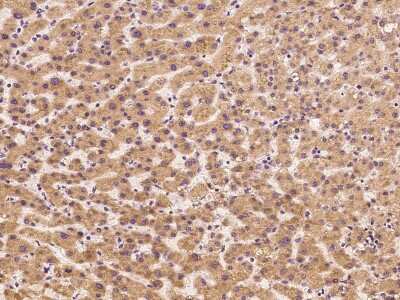 Immunohistochemistry-Paraffin: Fetuin Antibody [NBP2-99415]