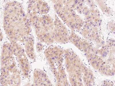 Immunohistochemistry-Paraffin: Fetuin Antibody [NBP2-99415]