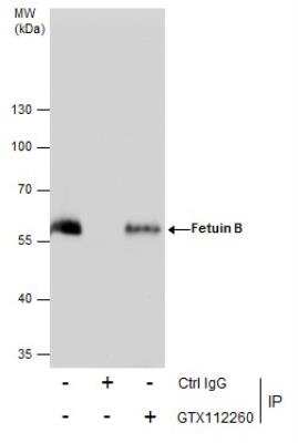 Immunoprecipitation: Fetuin Antibody [NBP2-16470]