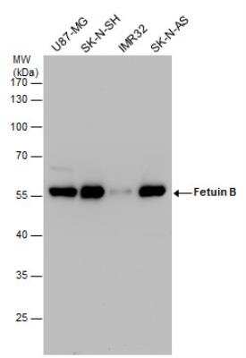 Western Blot: Fetuin Antibody [NBP2-16470]