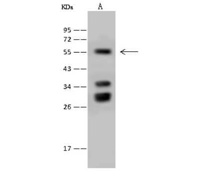 Western Blot: Fetuin Antibody [NBP2-99415]